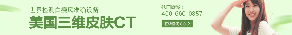 广州检测白癜风最准确的